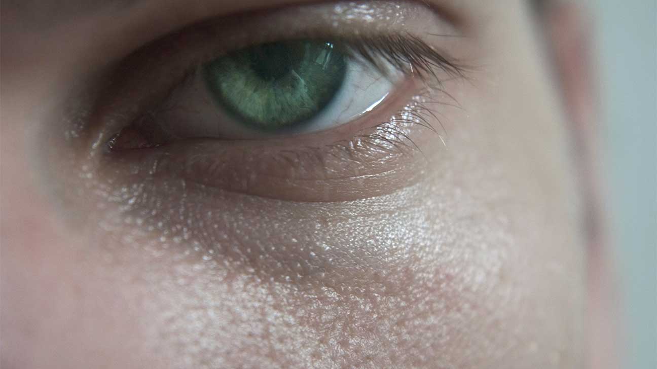 What Do Heroin Eyes Look Like?